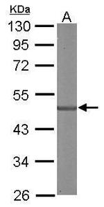 SDCCAG3 Isoform 1 Polyclonal Antibody