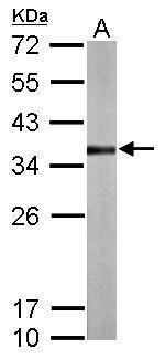 TST Antibody in Western Blot (WB)