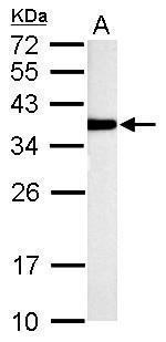 TST Antibody in Western Blot (WB)