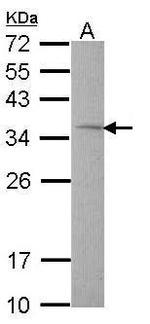 TST Antibody in Western Blot (WB)