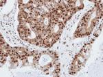 PDE4C Polyclonal Antibody
