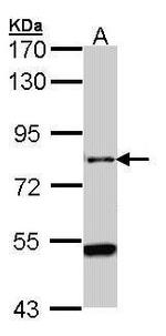 AGAP1 Antibody in Western Blot (WB)