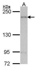 ARAP1 Polyclonal Antibody