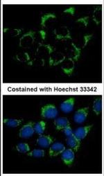 CMG1 Polyclonal Antibody