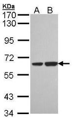 SNX18 Antibody in Western Blot (WB)