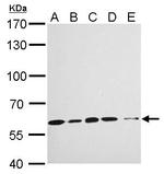 KPNA4 Antibody in Western Blot (WB)