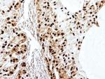 SET Antibody in Immunohistochemistry (Paraffin) (IHC (P))