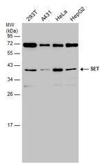 SET Antibody in Western Blot (WB)
