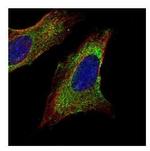 TOM1L1 Polyclonal Antibody