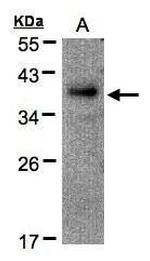 RAD51AP1 Antibody in Western Blot (WB)