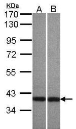 Centaurin alpha-1 Antibody in Western Blot (WB)