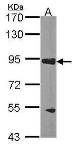 RASA3 Polyclonal Antibody