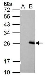 RGS17 Antibody in Western Blot (WB)