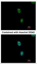 SAP130 Polyclonal Antibody