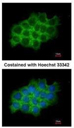SEC61A1 Polyclonal Antibody