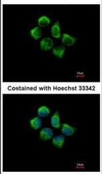 SNX12 Polyclonal Antibody