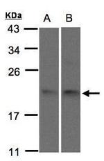 SNX12 Antibody in Western Blot (WB)