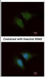 Coronin 3 Polyclonal Antibody