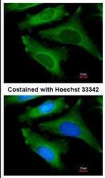 IL1RA Polyclonal Antibody