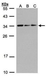 SARNP Antibody in Western Blot (WB)
