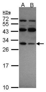 RPS4X Antibody in Western Blot (WB)