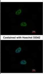 TWA1 Polyclonal Antibody