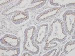 YIPF4 Polyclonal Antibody