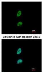 PSME3 Polyclonal Antibody
