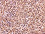 ACMSD Polyclonal Antibody