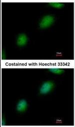 TPRKB Polyclonal Antibody