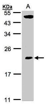 TPRKB Antibody in Western Blot (WB)