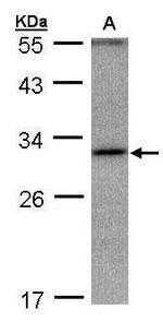 ANKRD45 Antibody in Western Blot (WB)