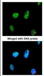 TATDN1 Polyclonal Antibody