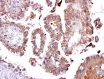 TATDN1 Antibody in Immunohistochemistry (Paraffin) (IHC (P))