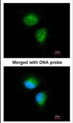 MMACHC Polyclonal Antibody