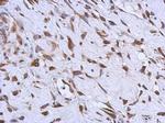 MMACHC Antibody in Immunohistochemistry (Paraffin) (IHC (P))