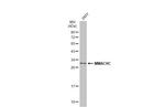 MMACHC Antibody in Western Blot (WB)