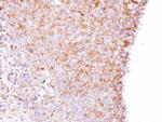 Coronin 1B Polyclonal Antibody