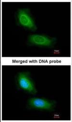 CCDC68 Polyclonal Antibody