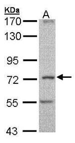 DNAI2 Polyclonal Antibody
