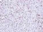 ZNF707 Antibody in Immunohistochemistry (Paraffin) (IHC (P))