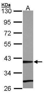 ZNF707 Antibody in Western Blot (WB)