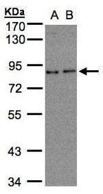 ZER1 Antibody in Western Blot (WB)