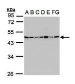 SUCLG2 Antibody in Western Blot (WB)