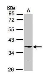 BXDC1 Polyclonal Antibody