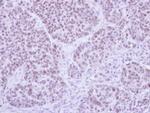 FHL5 Antibody in Immunohistochemistry (Paraffin) (IHC (P))