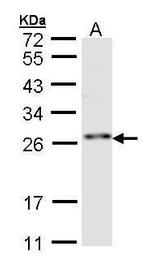 ZNF313 Antibody in Western Blot (WB)