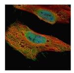 GLE1 Antibody in Immunocytochemistry (ICC/IF)