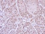 GLE1 Antibody in Immunohistochemistry (Paraffin) (IHC (P))