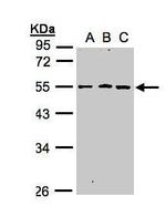 RGMB Antibody in Western Blot (WB)